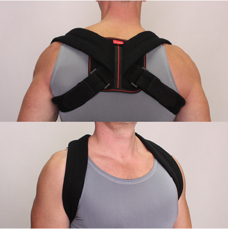 Купити Реклинатор жесткой фиксации ключичный (Кольца Дельбе)